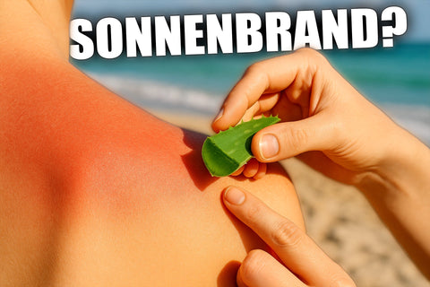 Sonnenbrand? Aloe Vera wirkt sofort!
